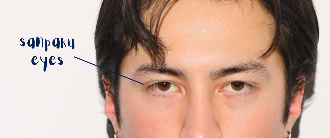 What Are Sanpaku Eyes?