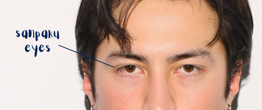 What Are Sanpaku Eyes?